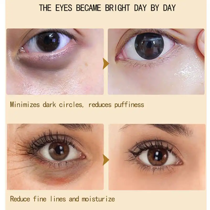 cream for crow's feet