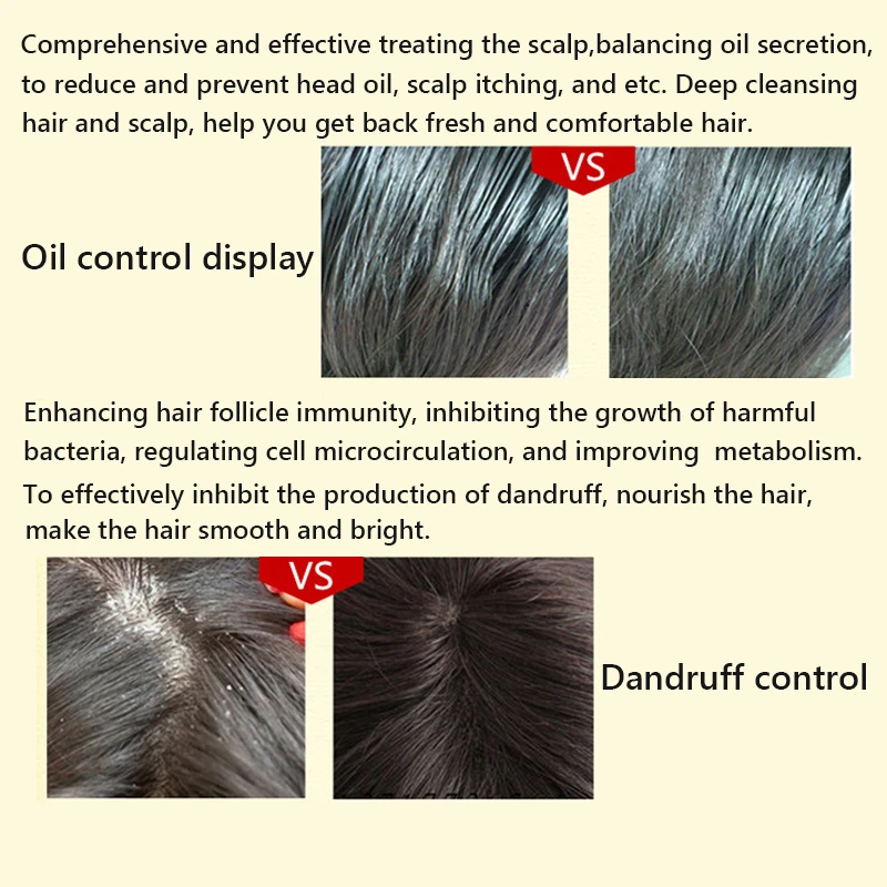 Old-Ginger-Shampoo-Dandruff-Improve-Oil-Control-Moisturizing-Nutrition-Scalp-Care-Hair-Clean-Smooth-Bright-Product