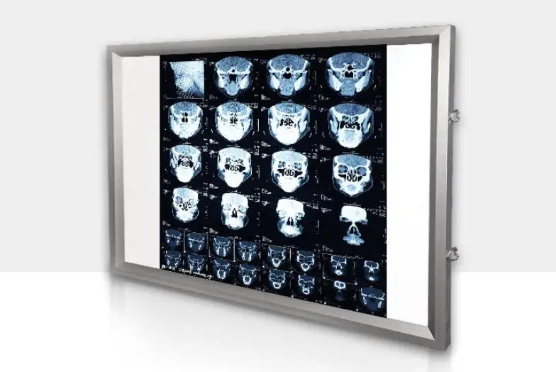 

Hospital X-ray Lamp LED Ultra-thin Triple Orthopaedic Reading Lamp Box Remote Control Dimming Single-double Viewing Lamp