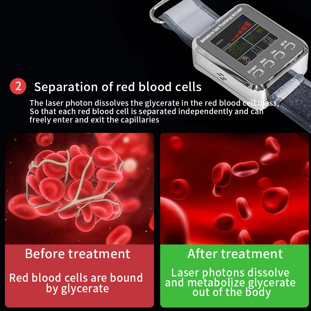 Advanced Laser Therapy Wrist Device for Diabetes & Hypertension Treatment