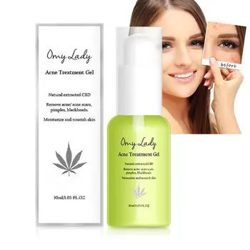 

30ml Aloe Acne Dispelling Ointment Plaster Removal Cream Face Skin Care Aloe Vera Gel Anti-Acne Oil Control
