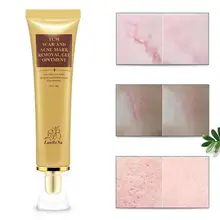 Натуральная трава увлажняющий шрам-для удаление геля для постугревых рубцов удаление всех типов кожи, как мазь на картинке 30 г гель