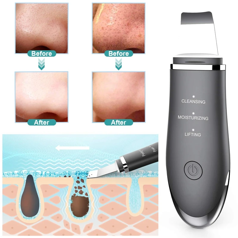 NEW-Blackhead Remover- Facial Skin Scrubber- 3 Modes Pore Cleaner Comedones Extractor Peeling Tool Usb Rechargeable Skin Massa