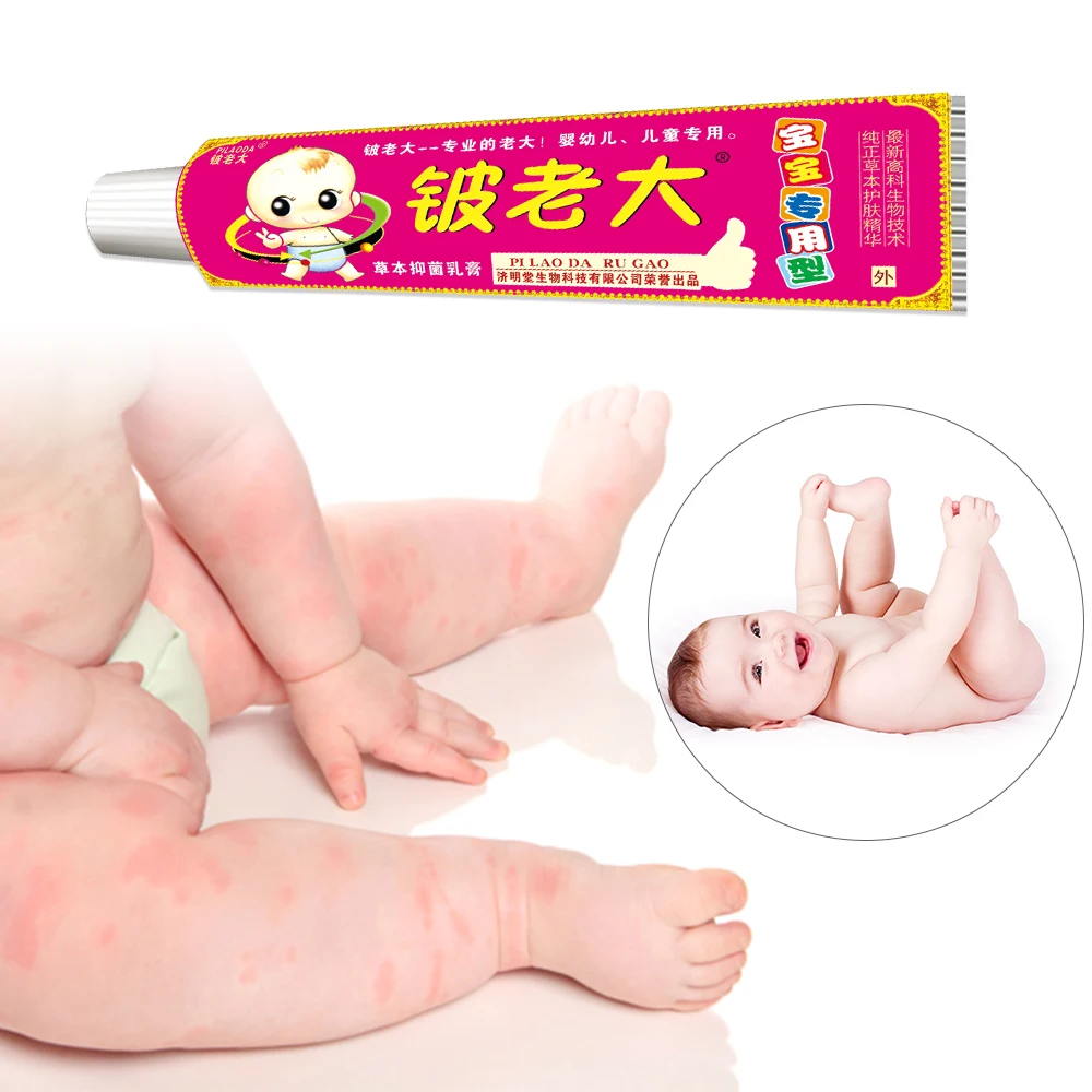 KONGDY, 1 шт., Детский Крем для лечения Eczema, антибактериальный на коже, для детей, подавляет дискомфорт, безопасный