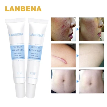 

LANBENA EGF Remover Scar Cream Stretch Mark Anti Acne Cream Acne Treatment Blackhead Whitening Skin Care Repair Face Cream 2PCS
