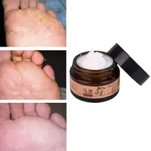 Лошадь масло для рук и ног ремонт крем для ног обувь из грубой ткани на каблуке ороговевшей кожи пилинг для ног, массажер для ног, стойкий к растрескиванию крем