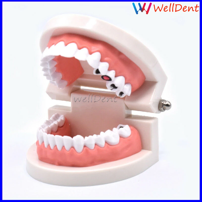Dental-Study-Teaching-Teeth-Model-Caries-Tooth-Care-_57 (1)