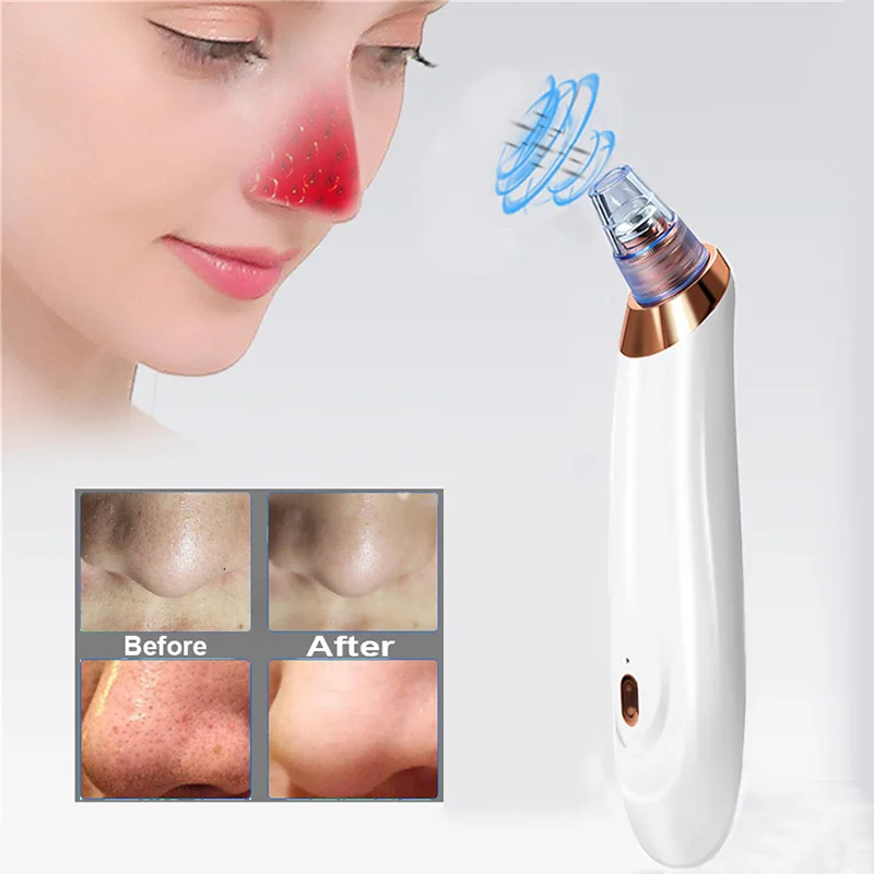 

Vytalbrush Blackhead Remover Face Skin Care Pore Acne Pimple Removal Vacuum Suction Tool Dermabrasion Machine Dropshipping