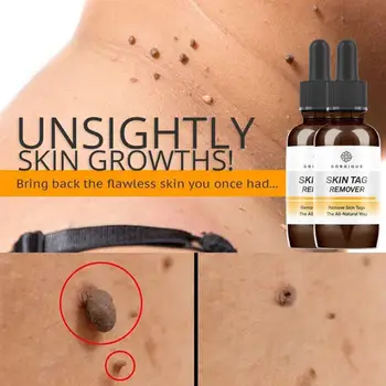 

10/20/30ml Skin Tag Remover Mole Foot Corn Wart Care Pure Acid Essence 100% Essence Hyaluronic Serum Natural Oil I3L5