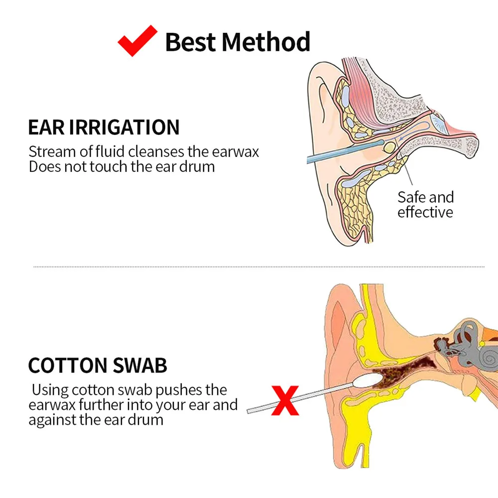 Система для мытья ушей, безопасная система для чистки ушей, набор для полива ушной раковины, бытовой инструмент для чистки ушей для взрослых и детей 31