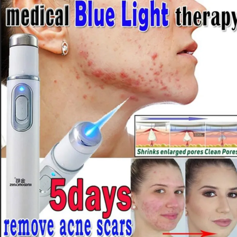 Facial Skin Care Tool Dark Spot Scar Remover Laser Plasma Pen Mole Tattoo Wart Removal Machine 1 Facial Skin Care Tool Dark Spot Scar Remover Laser Plasma Pen Mole Tattoo Wart Removal Machine 4