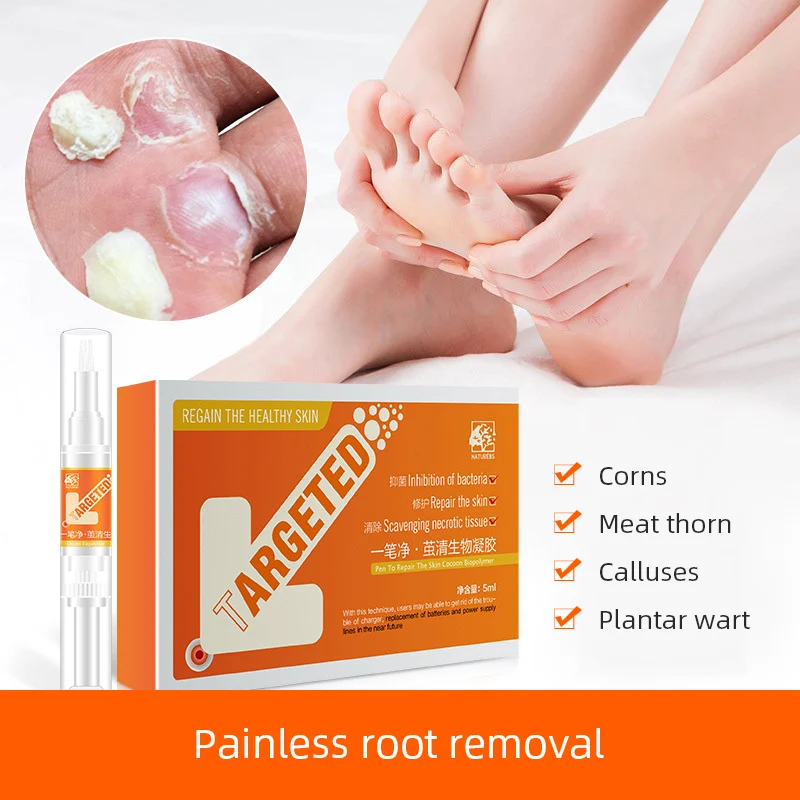 

Natural Ingredients Wart Remover Plantar Wart Removal Feet Corn Callus Remover Wart Pen