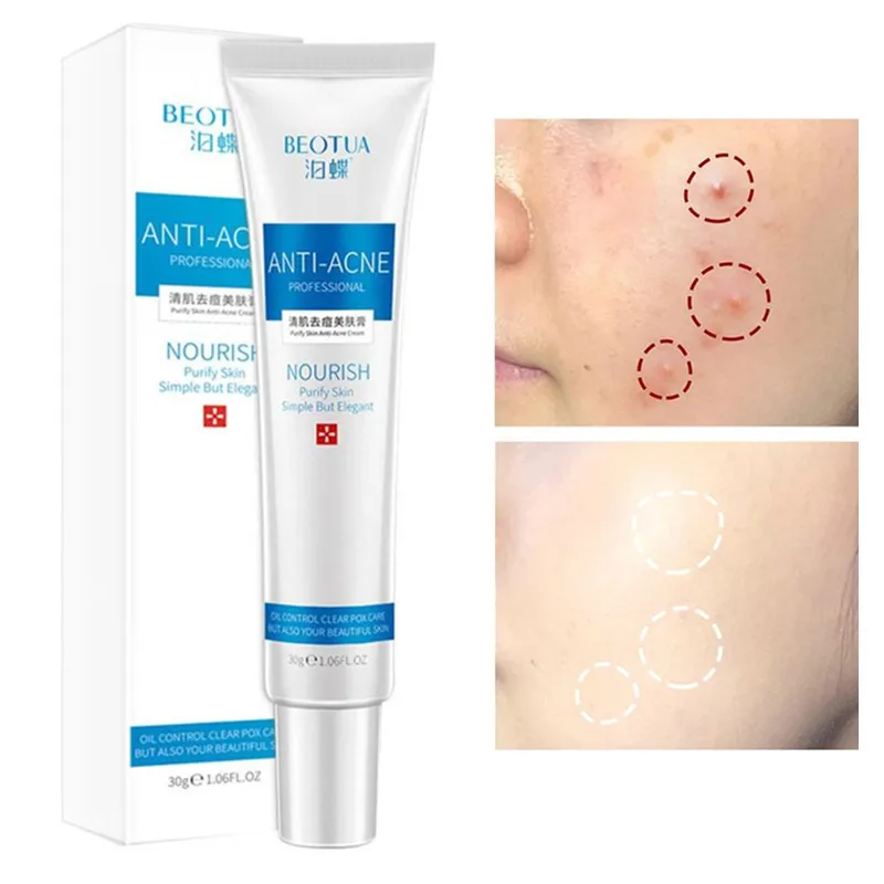 skin care products for pimples and dark spots