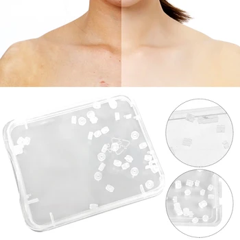 

30pcs/box Home Rubber Bands Warts Treatment Exfoliating Scrub Face Care Nevus Acne Body Mole Non Toxic Skin Tag Remover Painless