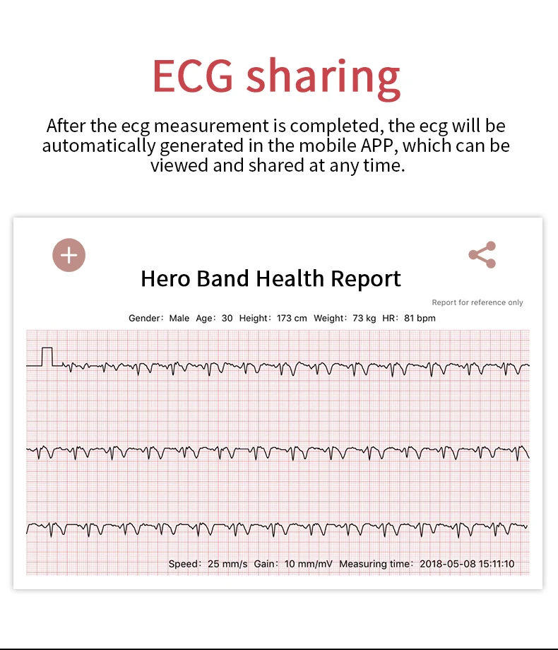Ravi B79 ECG Смарт-часы для женщин модный браслет PPG пульсометр кровяное давление монитор сна девушка леди SmartWatch педометр
