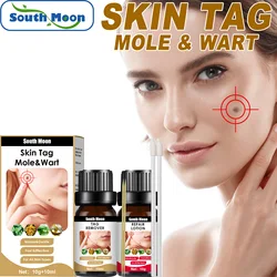 Warts Remover Against Moles Wart Liquid Treatment Cream Skin Tag Remover Herbal Extract Anti Verruca Remedy Wart Repair Ointment