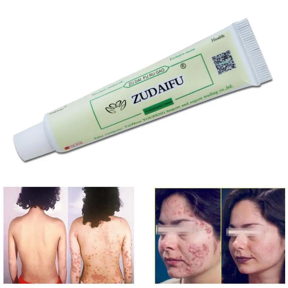 Псориаз для тела дерматит экзема зуд псориаз кремы ухода за кожей подбородка