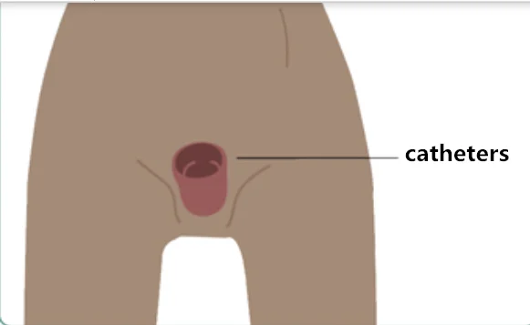 with tube no vagina Трансвестит силиконовые искусственная вагина брюки Трансвестит королева искусственный Голубь из латекса нижнее белье транссексуал Ложные киски для транссексуалов боди для мужчин - Цвет: with tube no vagina