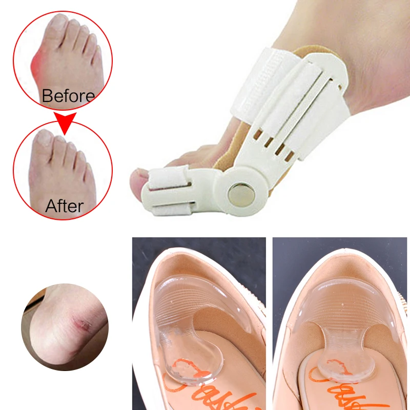 Daily Silicone Gel Foot Toe Separator Thumb Hallux Valgus Bunion Corrector Adjuster Thumb Orthopedic Braces Correct Feet Care