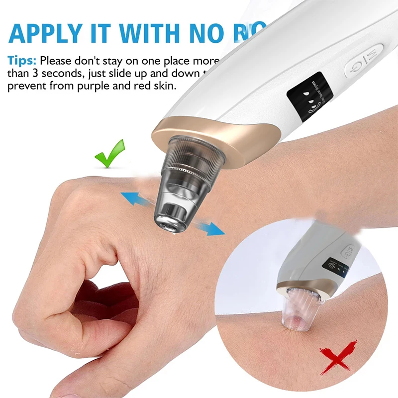 Vacuum Suck Black Spots Remove Blackheads Device Clean Pore Suction Pimples Squeezing Acne Clear Facial Dirt SPA Beauty Machine
