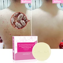 ESEENLO море мыло с солью Удаление прыщей поры, акне Уход очиститель увлажняющее масло семян Ши уход за кожей лица мыло для мытья базовый уход за кожей 80 г