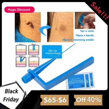 

skin tag remover remove Medical Skin Tag Kill mole wart treatment face Skin Tag Removal Tool Acne Remover Cleansing Micro Band