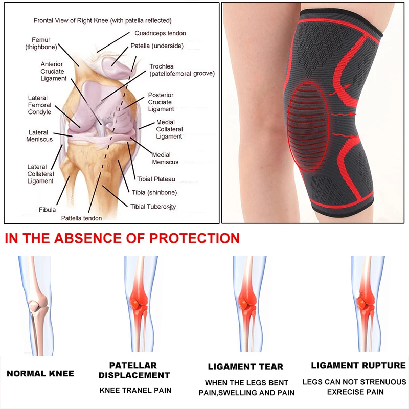 1PCS-Fitness-Running-Cycling-Knee-Support-Braces-Elastic-Nylon-Sport-Compression-Knee-Pad-Sleeve-for-Basketball-(1)