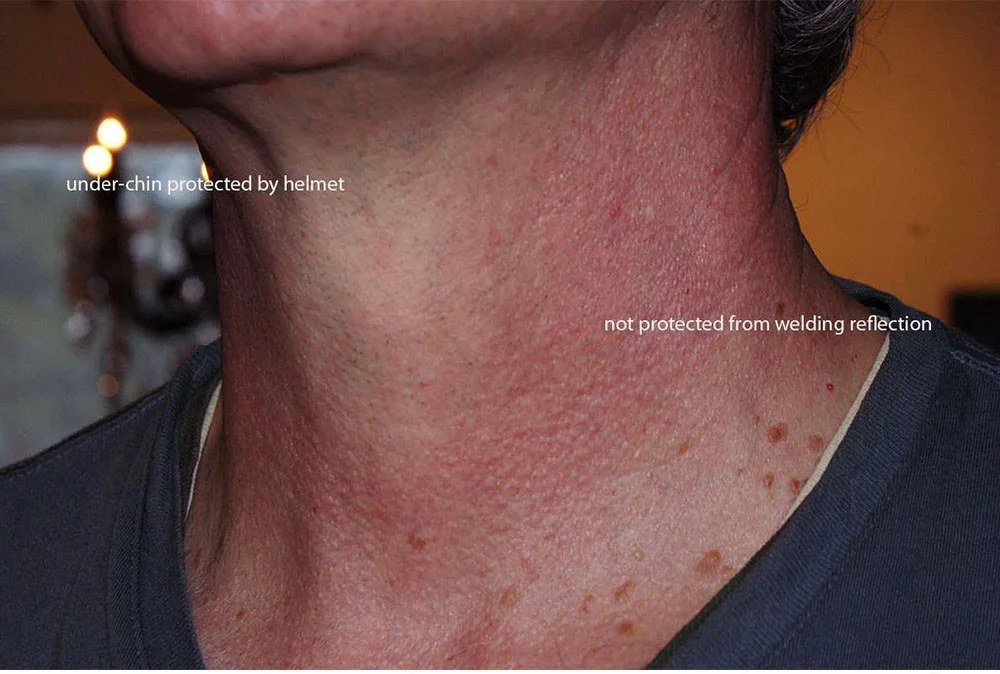 Solar Energy Automatic Changeable Light Electric Welding Protective Helmet with Line Pattern