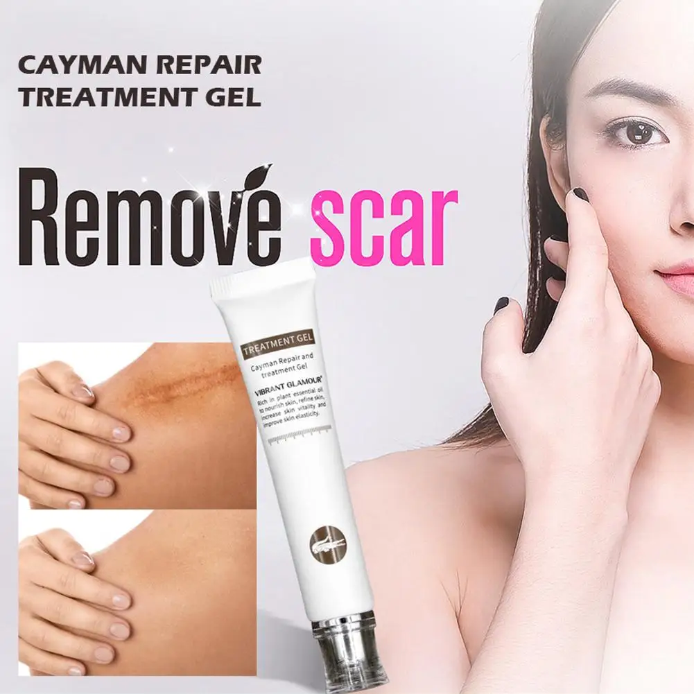 Scar Removal Cream Gel For Face Acne Scar Stretch Marks Remover Cream Skin Repair Face Cream For Burns Dilute Scars Skin