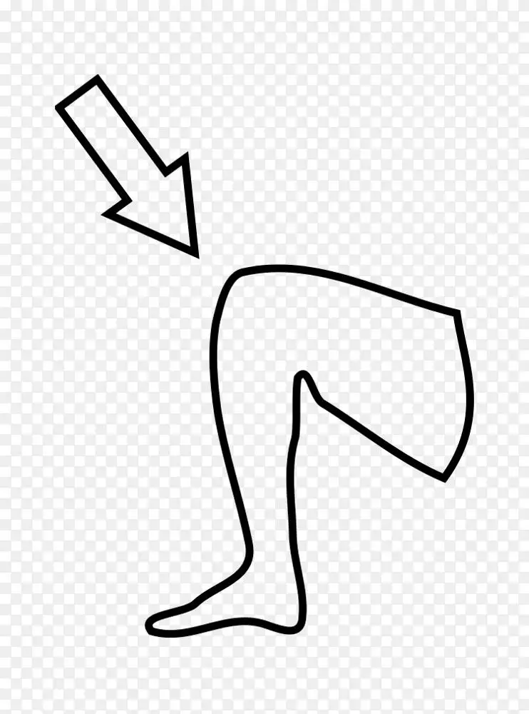 png膝关节疼痛夹术-膝关节图片