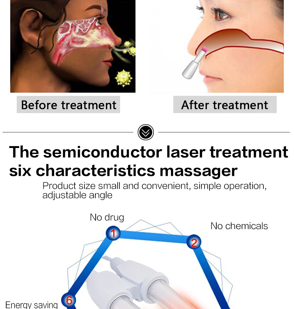 Носовая бионаза для носа, для лечения ринитов, носовой массажер, проволочный Сенной жар, Низкочастотный пульс для лазерного лечения ринита, терапевтический прибор, лазерный носовой массажер