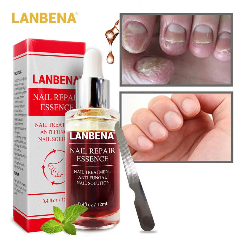 Купить сыворотку для ногтей. Сыворотка для восстановления ногтей Nail fungal solution. LANBENA сыворотка для ногтей. Средство от грибка ногтей LANBENA Nail Repair Essence 15 ml.