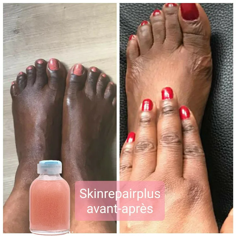 

Strong Hand and Feet Lightening Whitening Cleansing Serum To Clean Up Dark Knuckles Melting and brightening the skin 30ml