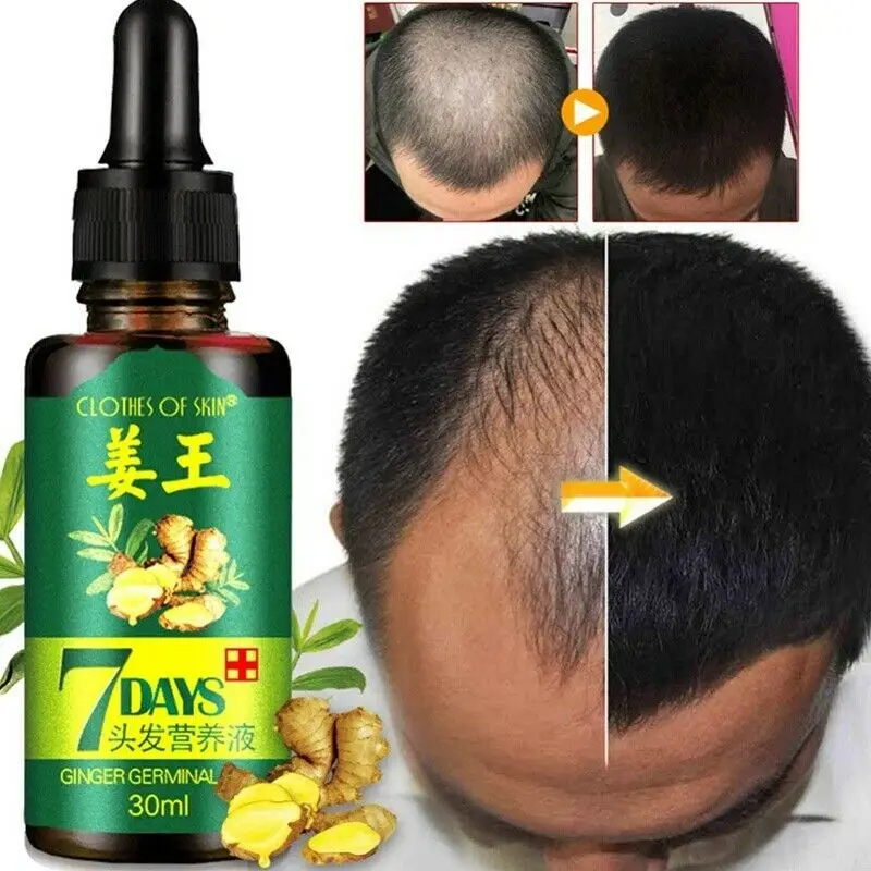 30ML Effective Fast Growth Hair Essence Hair Care Healthy Natural Anti-Hair Loss Oil Dense Hair Growth Liquid Dense