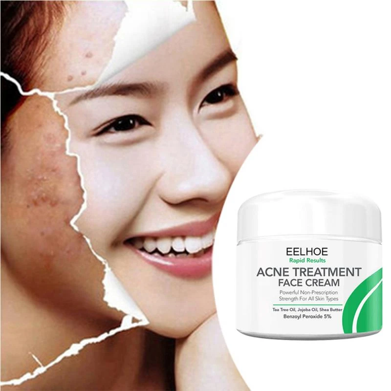 Eelhoe Treatment Cream 10/30/50g Anti Stains Acne Treatment Scar