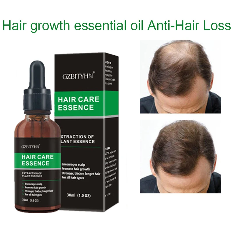 New Hair Growth Essence Oil Fast Powerful Hair Growth Oil Products Essential Oil Treatment Preventing Hair Loss Hair Care 30ml