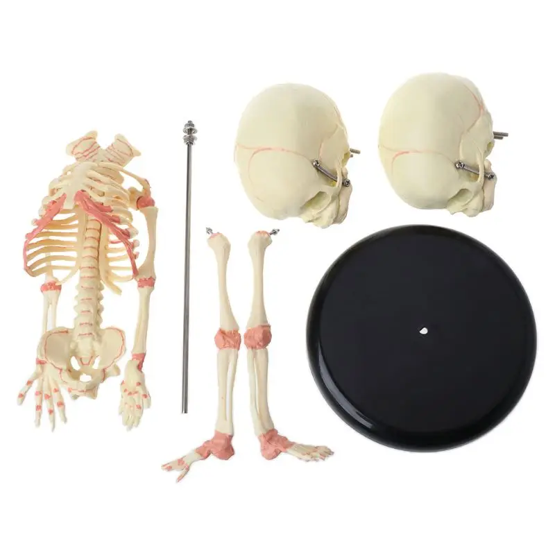  37cm Human Double Head Baby Skull Skeleton Anatomy Brain Display Study Teaching Anatomical Model - 4000040622886