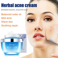 Для ремонта! Травяной Растительный крем от акне против пятен лечение шрамов, от угрей крем для очистки пор и отбеливания увлажняющий уход за кожей лица TSLM1