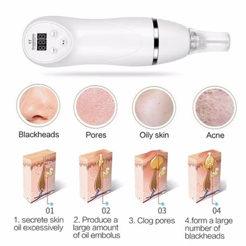 

Face Deep Pore Cleaning Blackhead Remover Acne Pimple Removal Vacuum Suction Facial SPA Diamond Beauty Care Tool Skin Care
