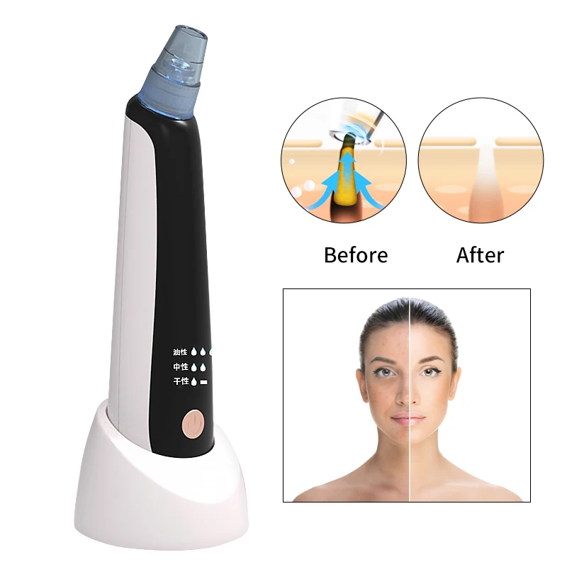 

New Electric Blackhead Deep Cleansing Acne Removal Instrument Facial Pores Clean Artifact Home Beauty Blackhead Instrument