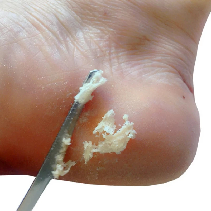 Manicure Pedicure Tools Toe Nail Shaver Feet Pedicure Knife Kit Foot Callus Rasp File Dead Skin Remover Foot Care Tools