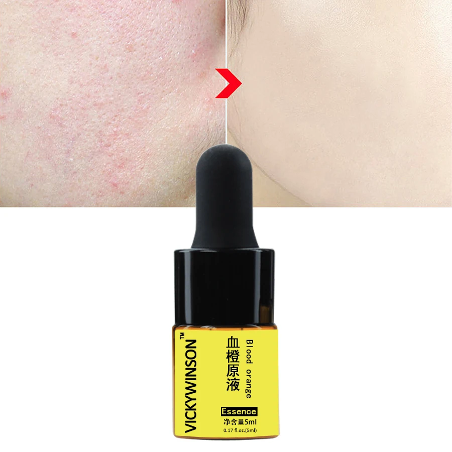 Blood Orange Essence 5ml Deep Rpair Antioxidant Facial Serum Lighten