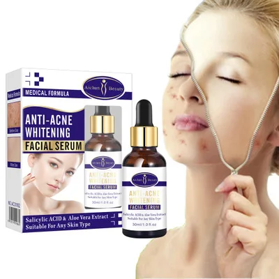 serum facial anti acne