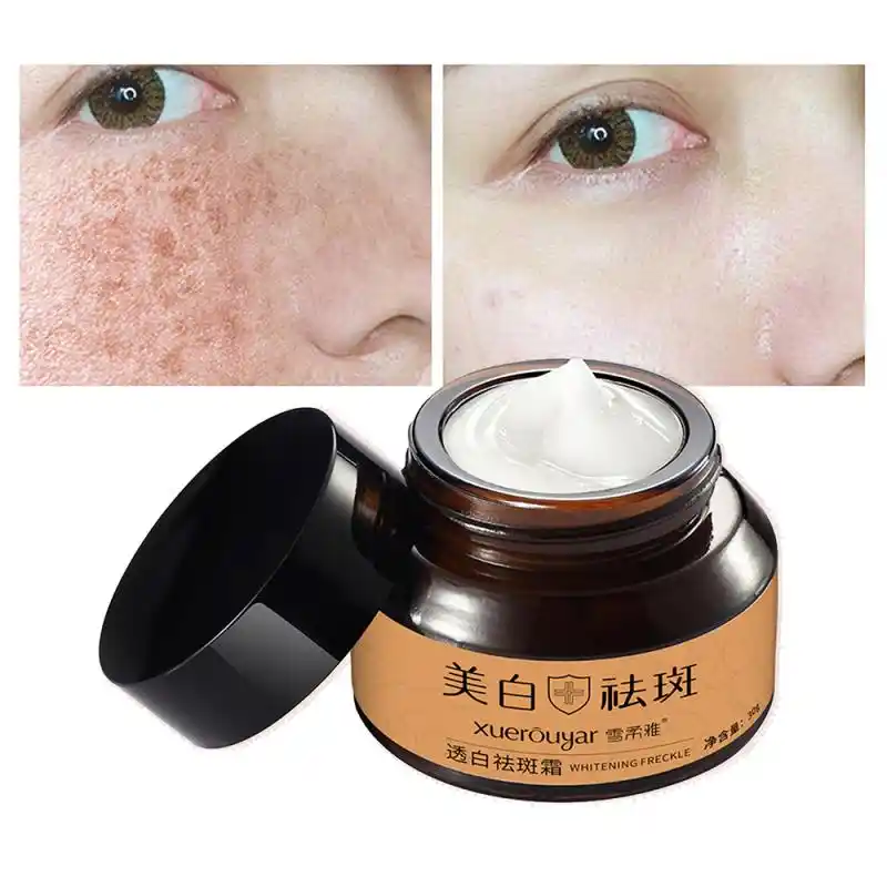 Face Cream Whitening Freckle Cream Remove Melasma Acne Spots Pigment Melanin Dark Spots Face Lift Firming Face Care Cream Korean Aliexpress