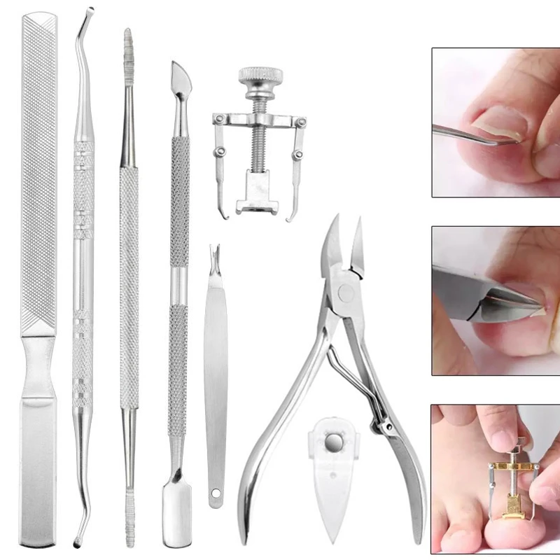 pensioen Vermenigvuldiging Subtropisch Professional Pedicure Tools Ingrown Toenail Tools Kit Nail Care Ingrown  Toenail Removal Correction Clippers Foot Care - Foot Care Tools - AliExpress