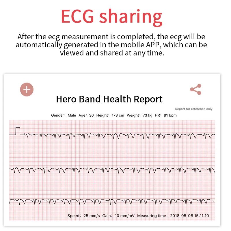 ECG PPG Смарт-часы для женщин с электрокардиограммой дисплей сердечного ритма кровяное давление смарт-Браслет фитнес-трекер Новинка
