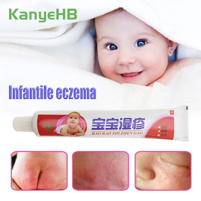 

1pcs Baby Skin Care Eczema Cream Body Psoriasis Pruritus Dermatitis Itching Pain Killer Herbal Medical Ointment Plaster S011