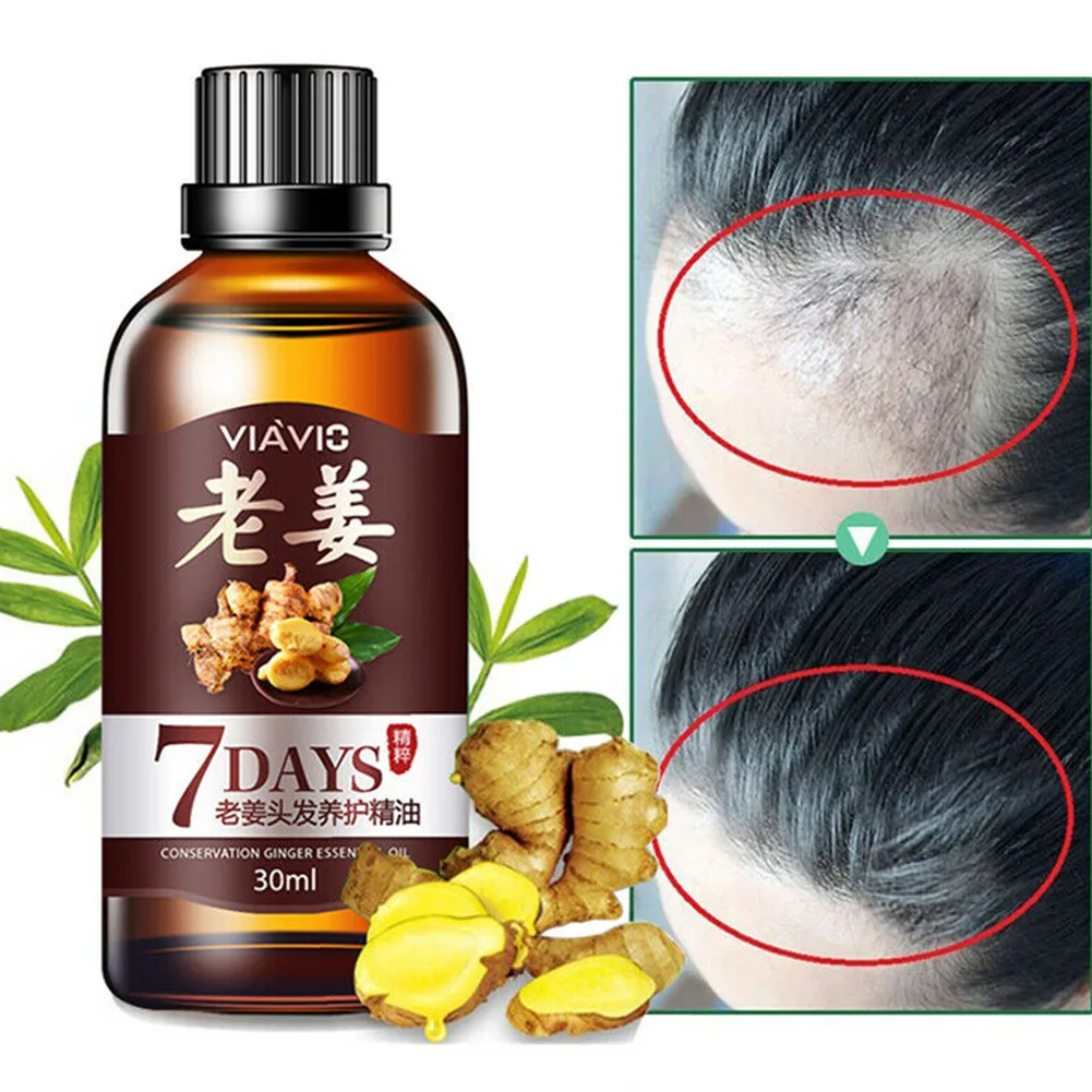 30ml Longer Essence Oil Moisturizing Thicker Ointment Ginger Ingredients Health Care Fast Hair Growth Natural Anti Loss