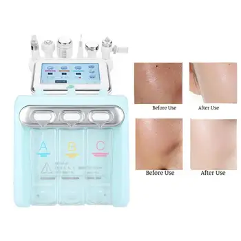 

Skin Spots Removal Pen 6 IN 1 Hydrogen Oxygen Beauty Machine Deep Cleaning Skin Rejuvenation Ultrasonic Instrument Led Facial