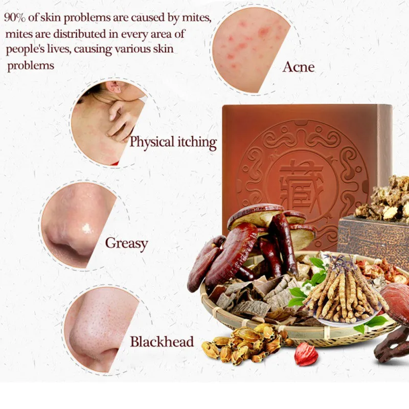 Тибетское мыло ручной работы увлажняющее масло-контроль сужение пор против клещей анти Очищение акне мыло